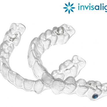 ¿Cómo Funciona Invisalign, la Ortodoncia Sin Brackets?