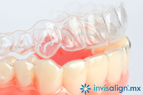 invisalign-alineador-transparente-ortodoncia.jpg