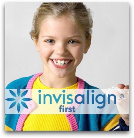 Invisalign-first.jpg