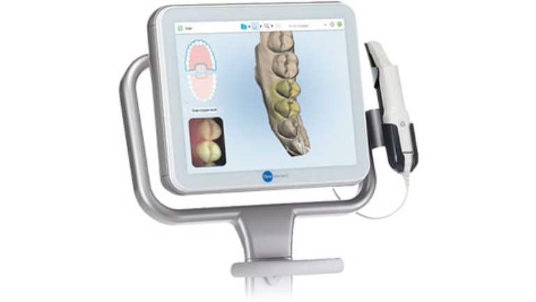 Solo con Invisalign tu Doctor Escanea tus Dientes en 3D con ITero