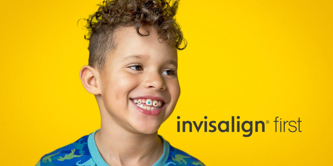 Invisalign-First.jpeg