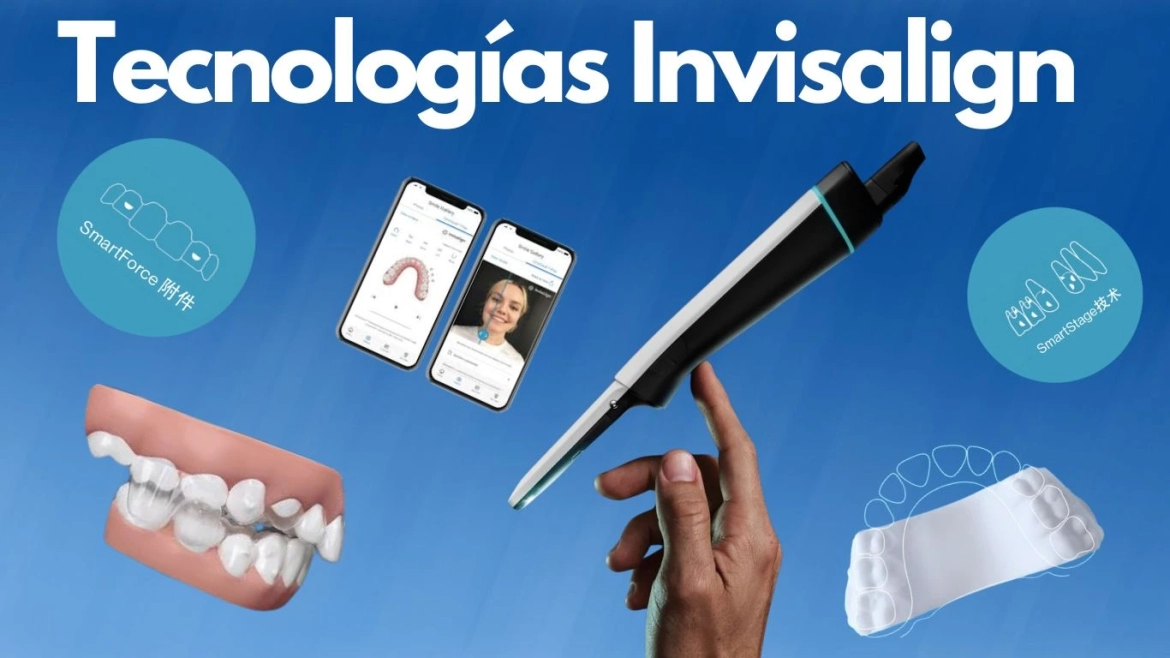 Tecnologia-Invisalign.webp