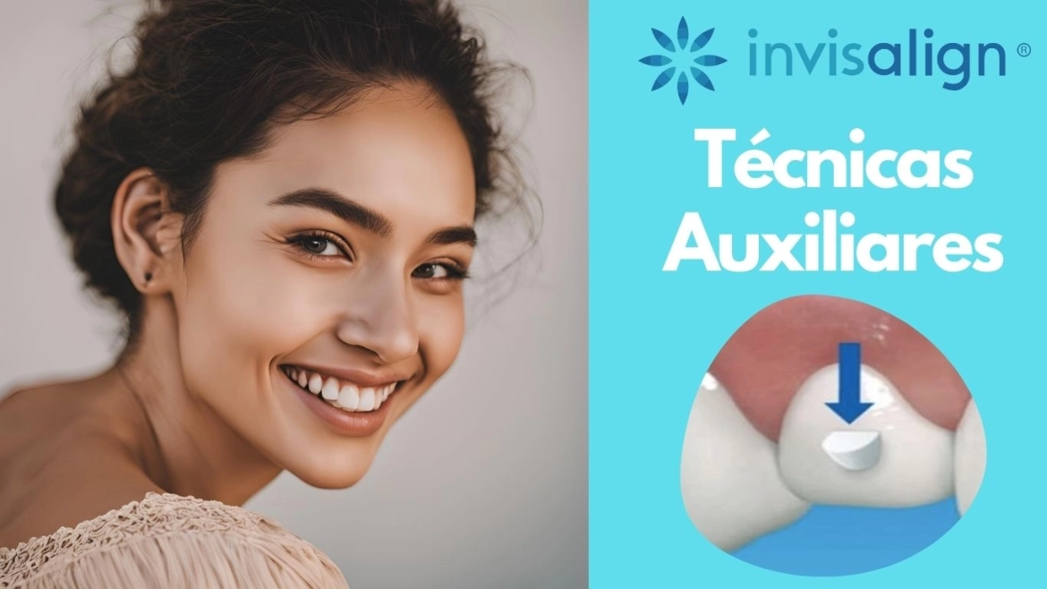 Tecnologias-Auxiliares-Invisalign.webp