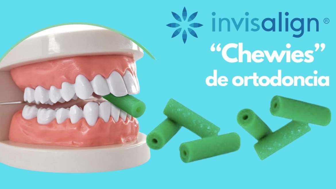 Chewies-de-Invisalign.webp