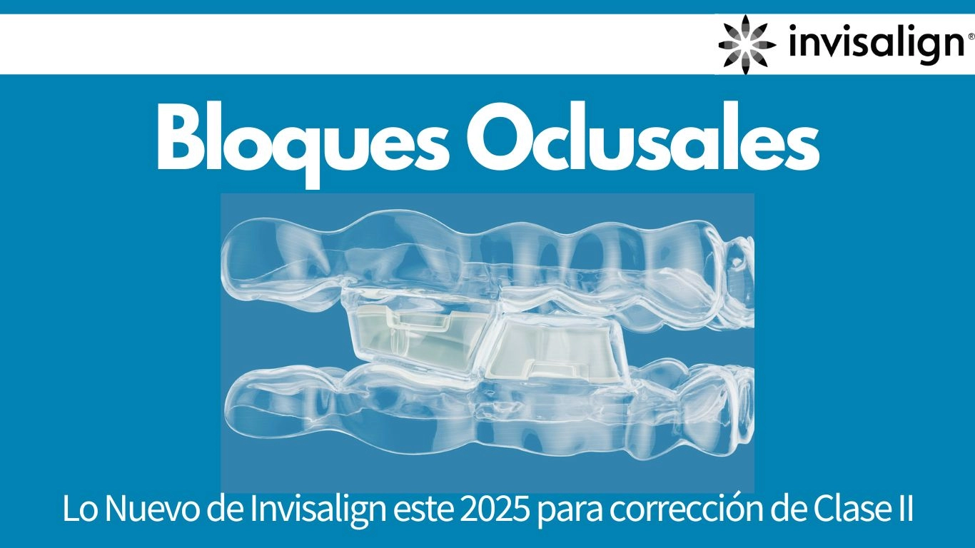 Nuevo Avance Mandibular con Bloques Oclusales de Invisalign ...