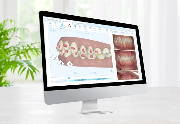 Itero-muestra-2.webp