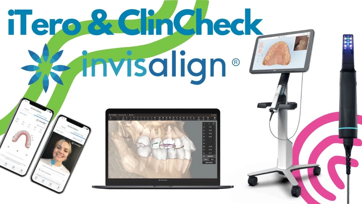 iTero-ClinCheck.webp