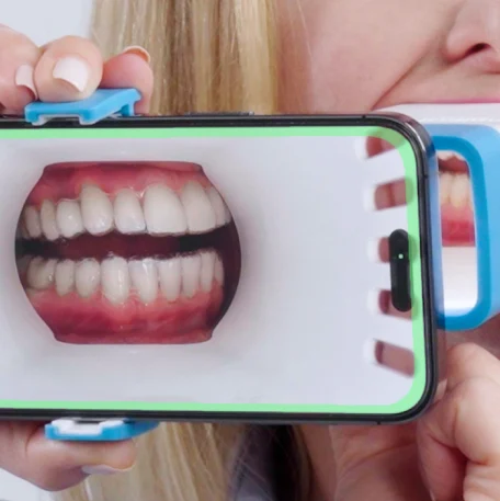 Invisalign Virtual Care AI®