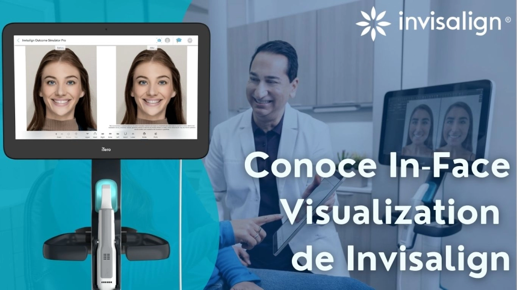 in-face visualization de invisalign
