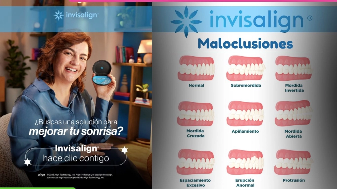 Invisalign-y-las-maloclusiones-dentales.webp