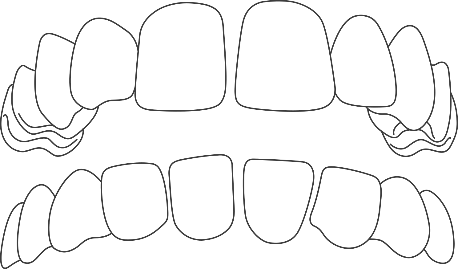 Corrección de diastema con Invisalign