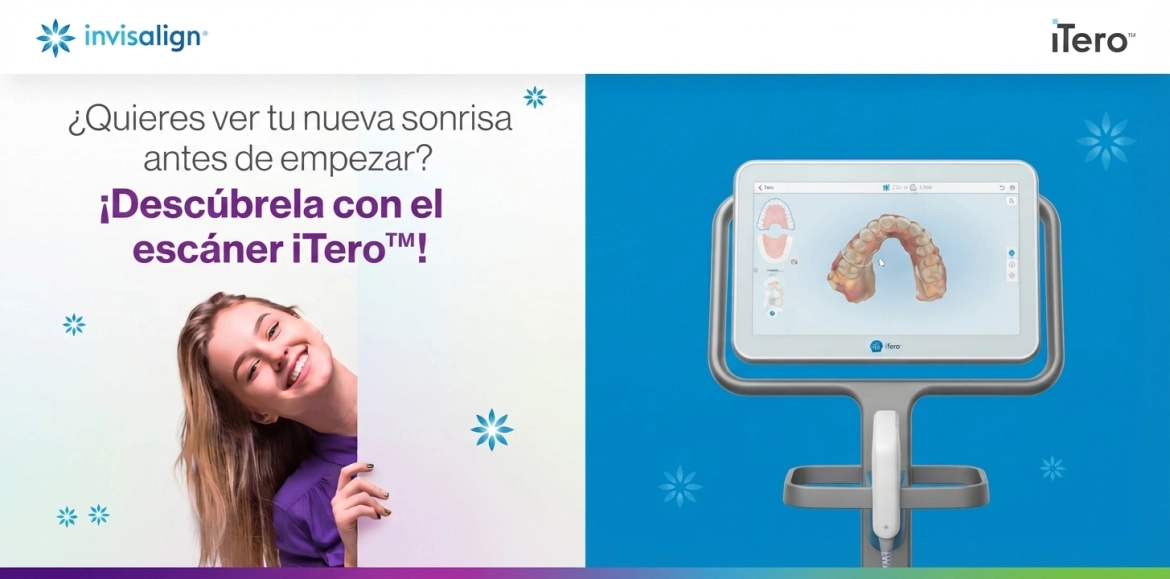 Invisalign-and-iTero-Teens.webp