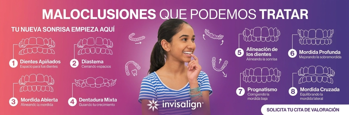 Maloclusiones-Invisalign-Teen.webp