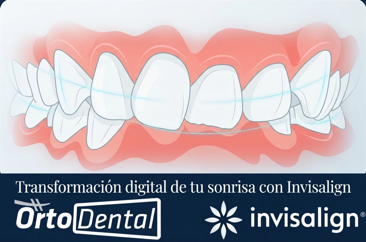 Ejemplo-Sobremordida-Invisalign-Page.webp